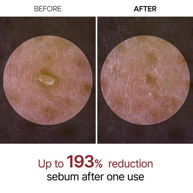 ✨✨Last Day 50%OFF:Miniyou™ Glow White Rice Peeling Ampoule