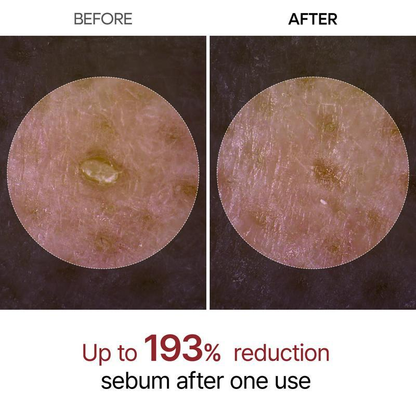 ✨✨Last Day 50%OFF:Miniyou™ Glow White Rice Peeling Ampoule